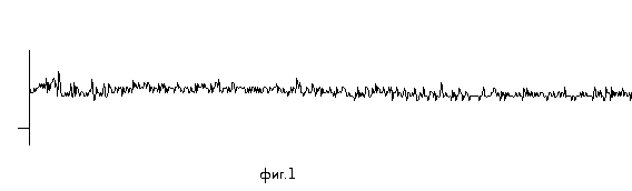 фиг.1