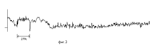 фиг.3